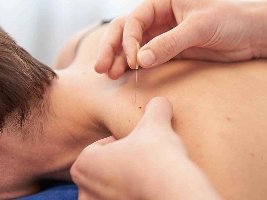 Dry needling -käsittely Kokkolassa